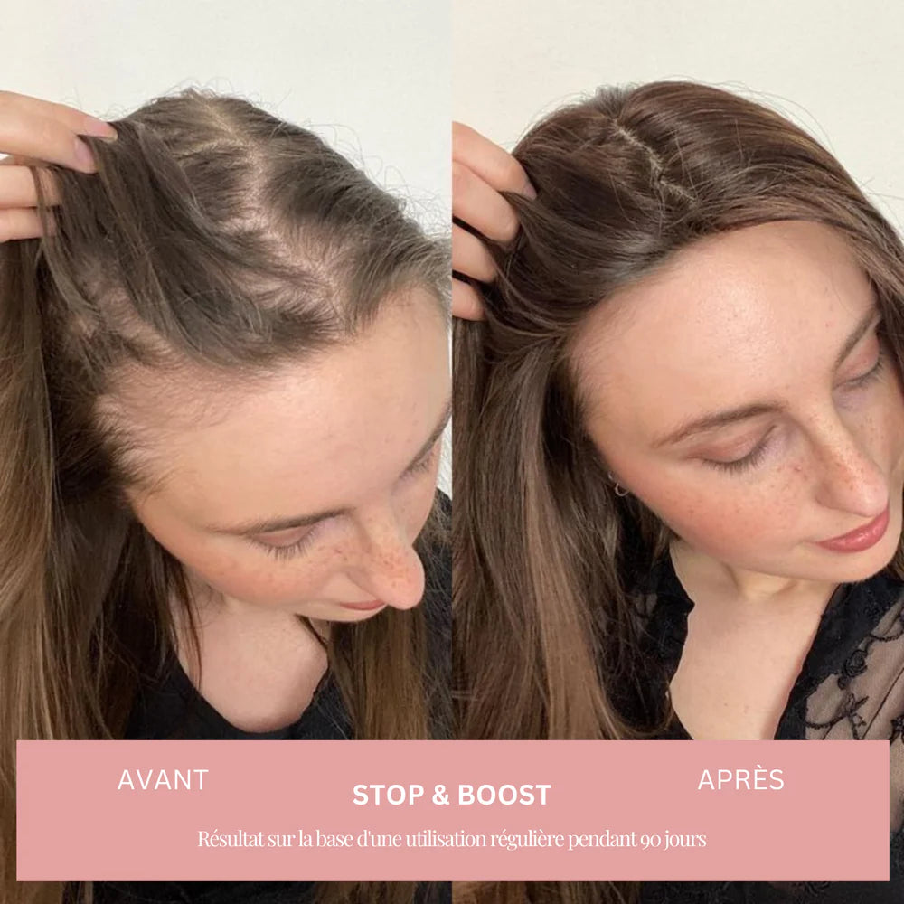 Kit Boost Anti-chute 100% naturel